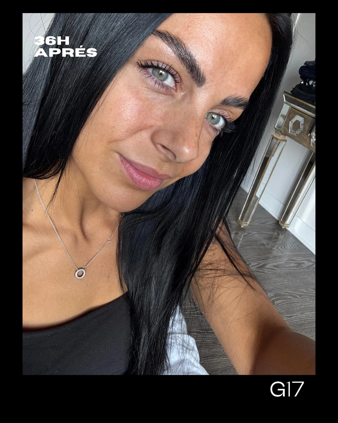 Nadine 36 heures après sa séance GLOW17, teinte NUDA Milkshake développée